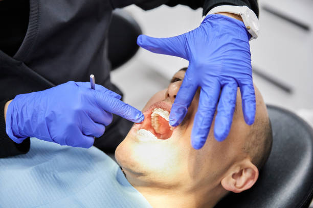 Best Emergency Tooth Extraction in Coopertown, TN